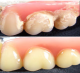 PPR (professionelle Zahnprothesenreinigung) und weitere Serviceleistungen